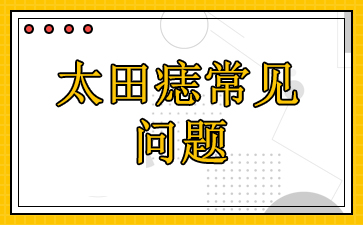广州去胎记哪家医院好-太田痣常见问题