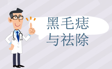 广州治胎记的公立医院-黑毛痣与祛除