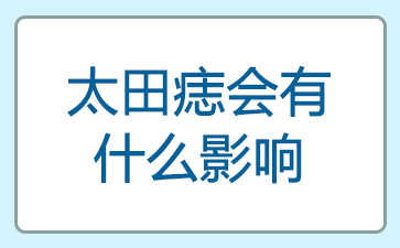 ����̫�������Ʒ���-̫�������ʲôӰ��