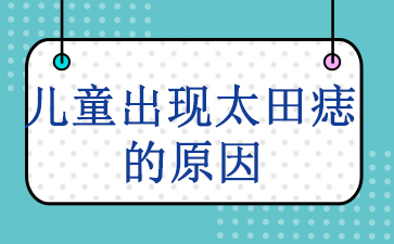 广州去胎记排名-儿童出现太田痣的原因