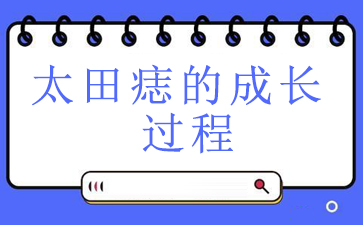 [������ǰ]�������������̫����_̫����ĳɳ�����